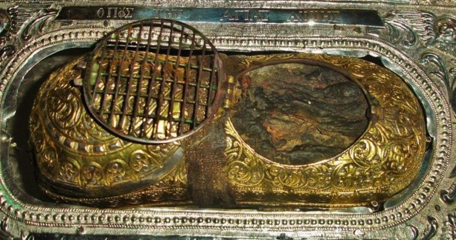 Σε θερμοκρασία «ζωντανού» σώματος το αριστερό πόδι της Αγίας Άννης