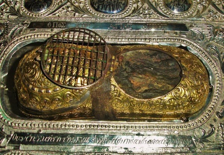 Σε θερμοκρασία «ζωντανού» σώματος το αριστερό πόδι της Αγίας Άννης