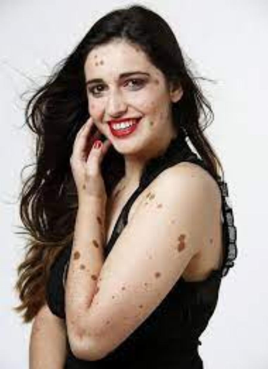 Αυτά τα 12 μοντέλα κατέρριψαν τα πρότυπα ομορφιάς και απέδειξαν ότι ο κάθε άνθρωπος είναι όμορφος