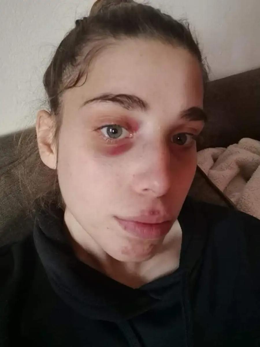 Ηράκλειο Κρήτης: Ποια είναι η γενναία 20χρονη που έβγαλε νοκ-άουτ επίδοξο ληστή