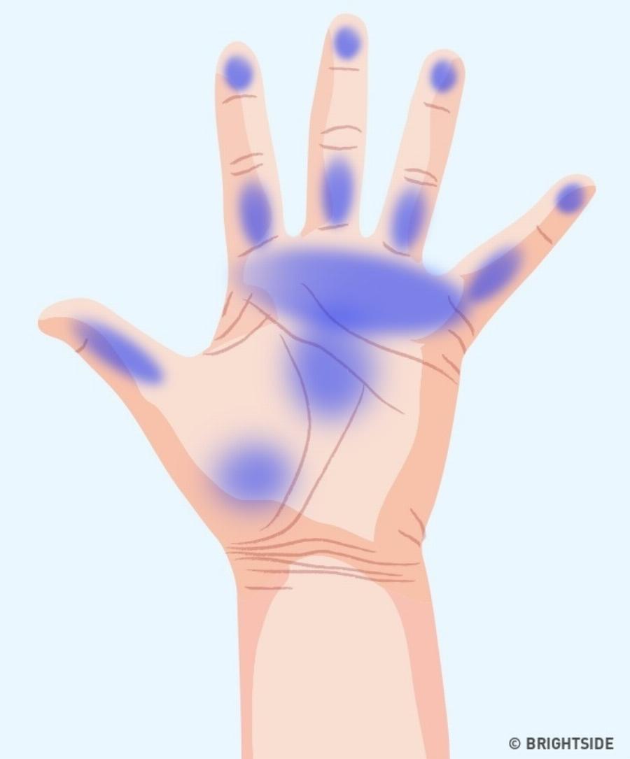 Τα 7 σημαντικά σημάδια στα χέρια μας που μαρτυρούν πράγματα για την υγεία μας