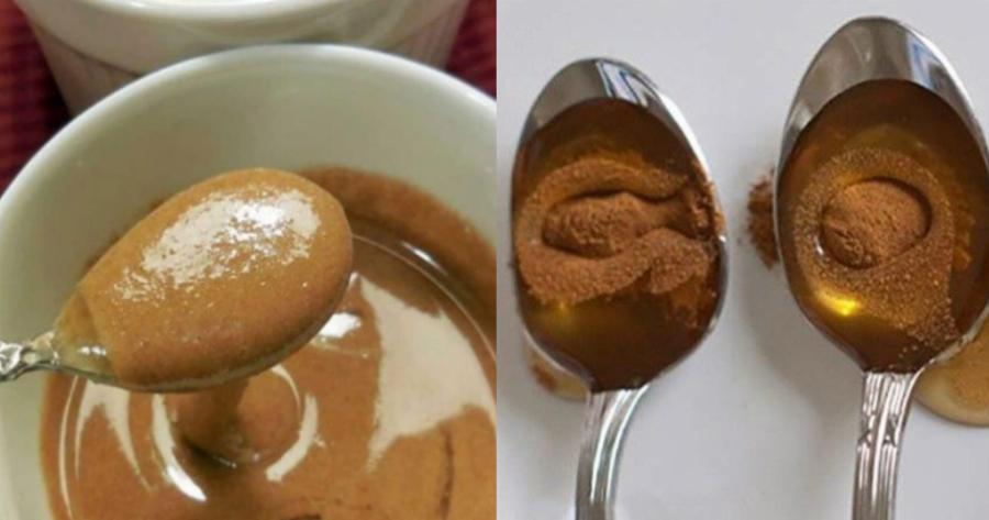 Μέλι με κανέλα: Ο μαγικός συνδυασμός για θεαματικές αλλαγές στο σώμα