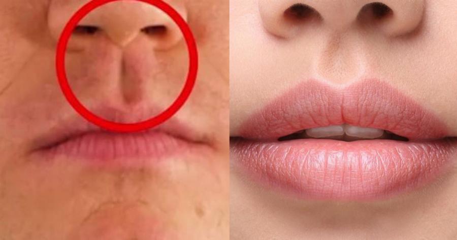 Που οφείλεται αυτό το μικρό “αυλάκι” στην κορυφή των χειλιών μας και ποια είναι η ονομασία του
