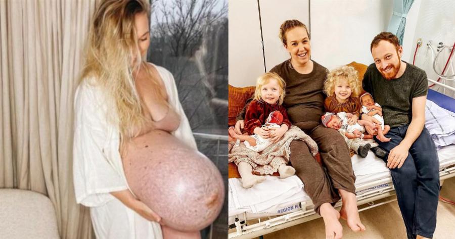 Μια μαμά περιγράφει: Πώς είναι να γεννάς τρίδυμα και οι 36 ώρες πόνου για το «θαύμα» της ζωής