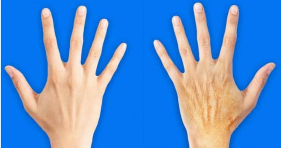 5 μυστικά για να κάνετε τα χέρια σας 10 χρόνια νεώτερα