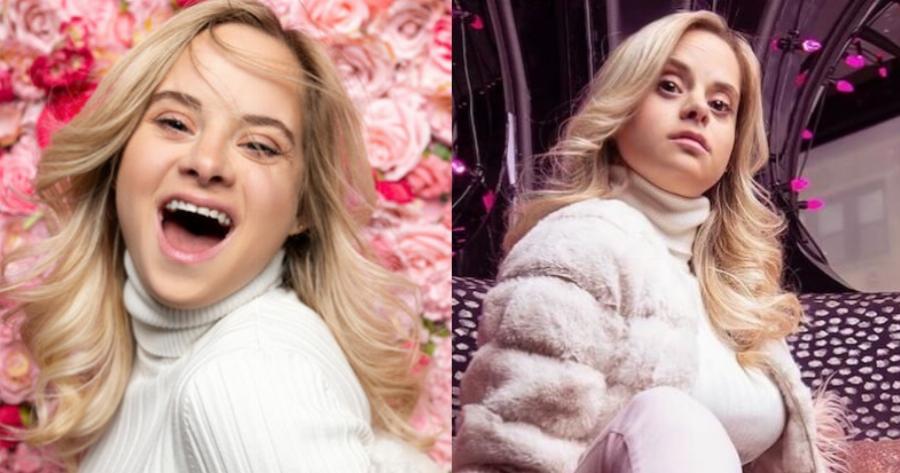 Victoria’s Secret: Το νέο της μοντέλο είναι η πανέμορφη Sofia Jirau με σύνδρομο Down