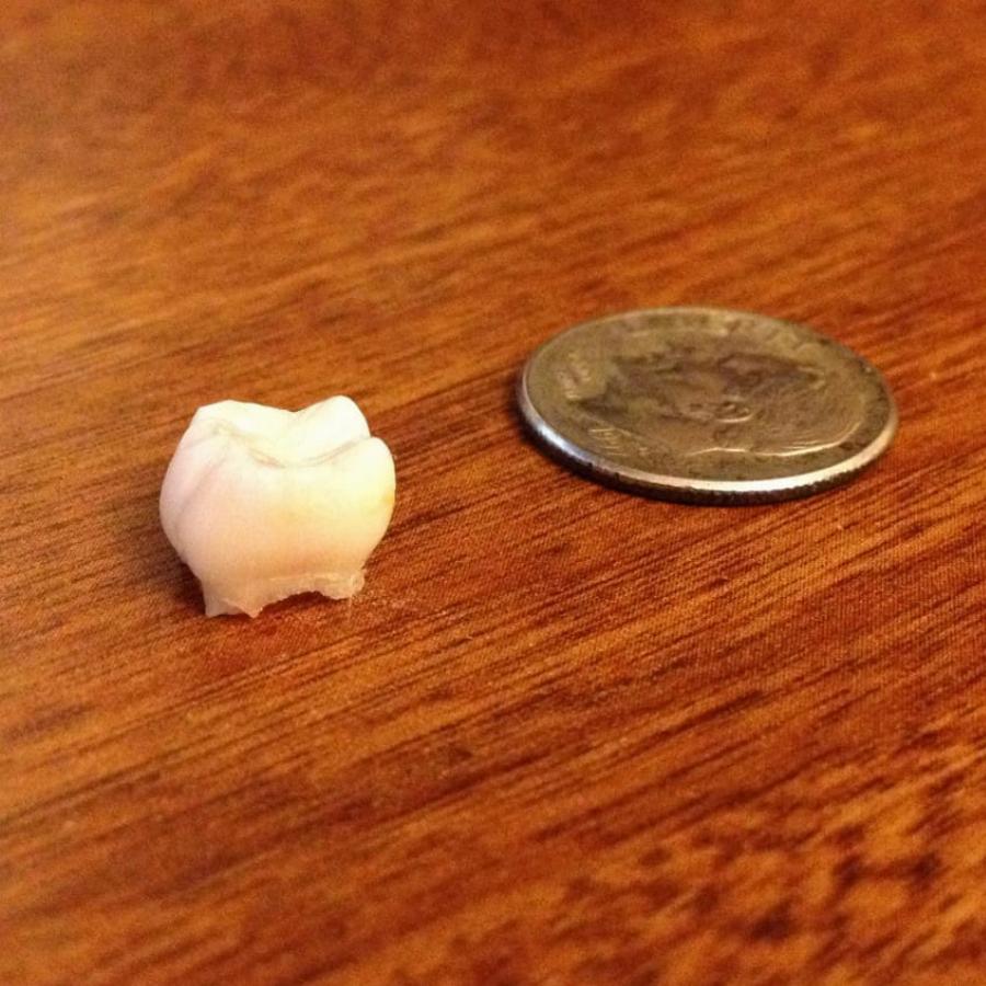 Πρώτα δόντια: Ο λόγος που επιβάλλεται να τα κρατάμε – Πως πρέπει να τα διατηρήσουμε