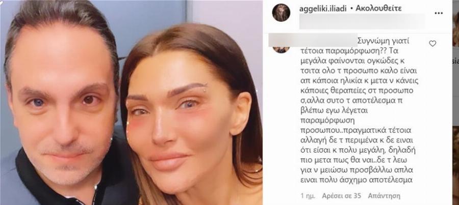 Αγγελική Ηλιάδη: Η αποστομωτική απάντησή της σε προσβλητικό σχόλιο για παραμόρφωση στο πρόσωπό