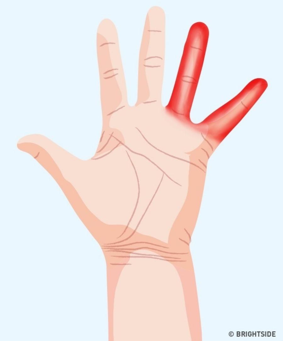 Τα 7 σημαντικά σημάδια στα χέρια μας που μαρτυρούν πράγματα για την υγεία μας