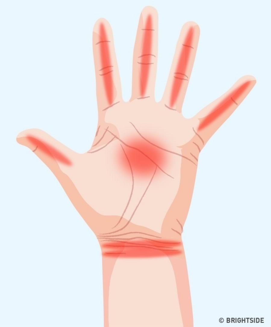 Τα 7 σημαντικά σημάδια στα χέρια μας που μαρτυρούν πράγματα για την υγεία μας