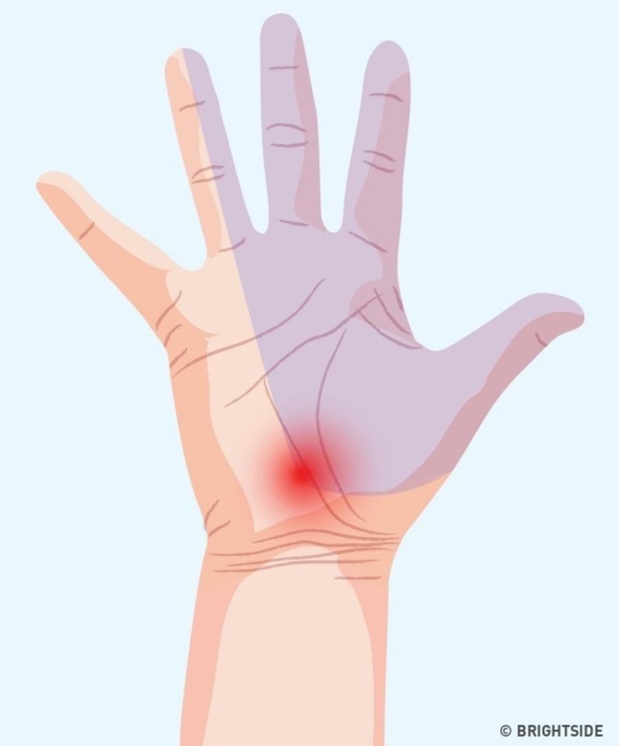 Τα 7 σημαντικά σημάδια στα χέρια μας που μαρτυρούν πράγματα για την υγεία μας