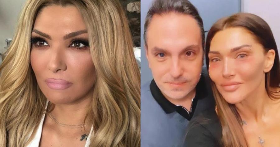 Αγγελική Ηλιάδη: Η αποστομωτική απάντησή της σε προσβλητικό σχόλιο για παραμόρφωση στο πρόσωπό