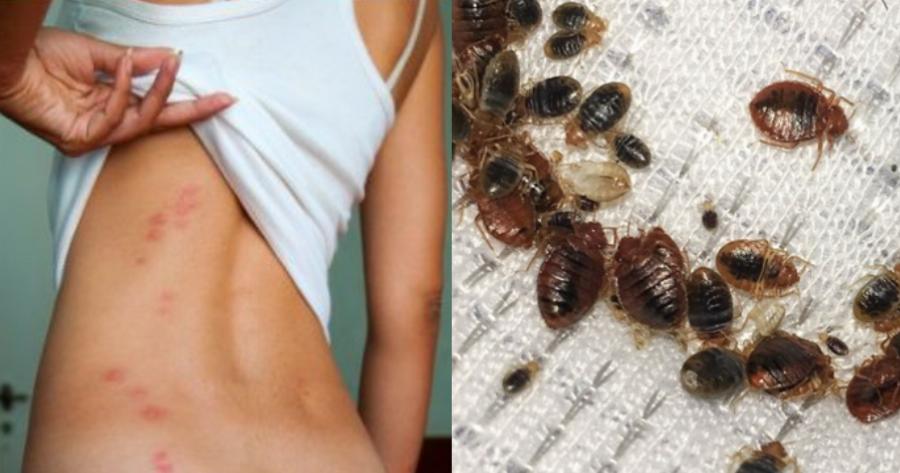 Κοριοί: Εμφανίζονται σε στρώματα, ρούχα και  κρεβάτια – Πως θα τους καταλάβετε και οι οδηγίες για να τους εξαφανίσετε