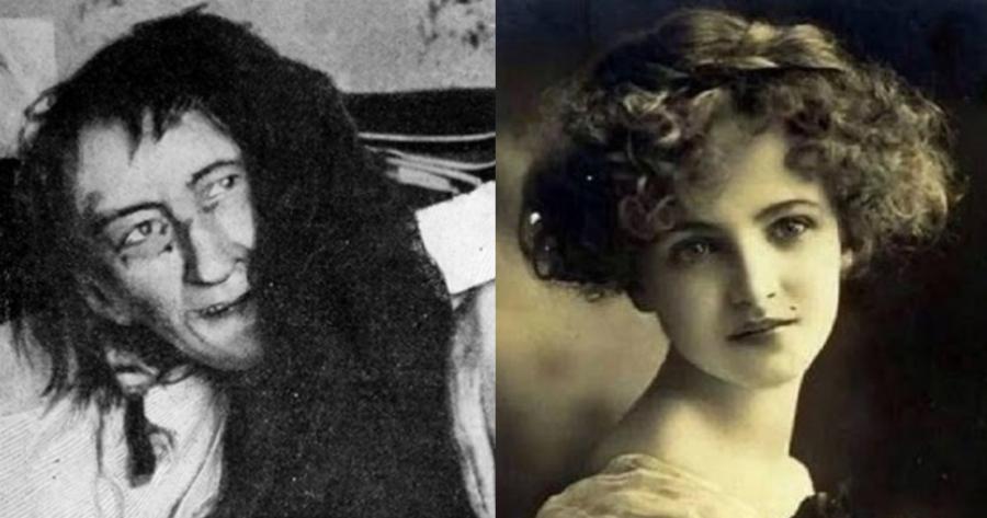 Γαλλία: Η απάνθρωπη τιμωρία μιας μητέρας στην κόρη της – Την κλείδωσε στη σοφίτα για 25 χρόνια στη, γιατί αγάπησε τον λάθος άντρα