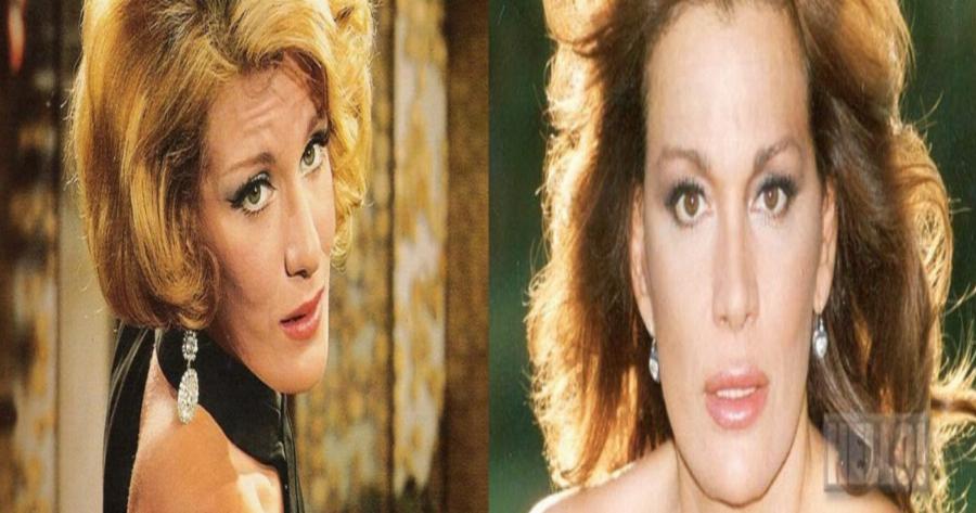 Μαίρη Χρονοπούλου: Οι αρραβώνες με τον Μπάρκουλη, ο γάμος με παντρεμένο, τα εγκαύματα στο πρόσωπο και το ατύχημα που την καθήλωσε