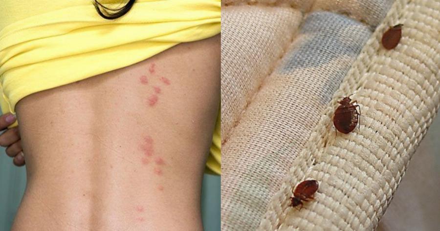 Κοριοί: Βρίσκονται σε στρώματα, ρούχα και κρεβάτια – Πως θα τους καταλάβετε και τι να κάνετε για να τους εξαφανίσετε