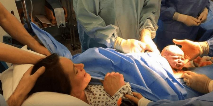 Μητέρα δείχνει την καισαρική τομή της και κλείνει το στόμα σε όσους την έκριναν πώς πήρε «τον εύκολο δρόμο»