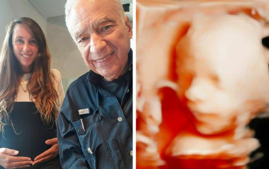 «Το μόνο που θέλω είναι να φτάσω τα 105 για να τον δω να αποφοιτά» – Γιατρός έγινε μπαμπάς στα 83