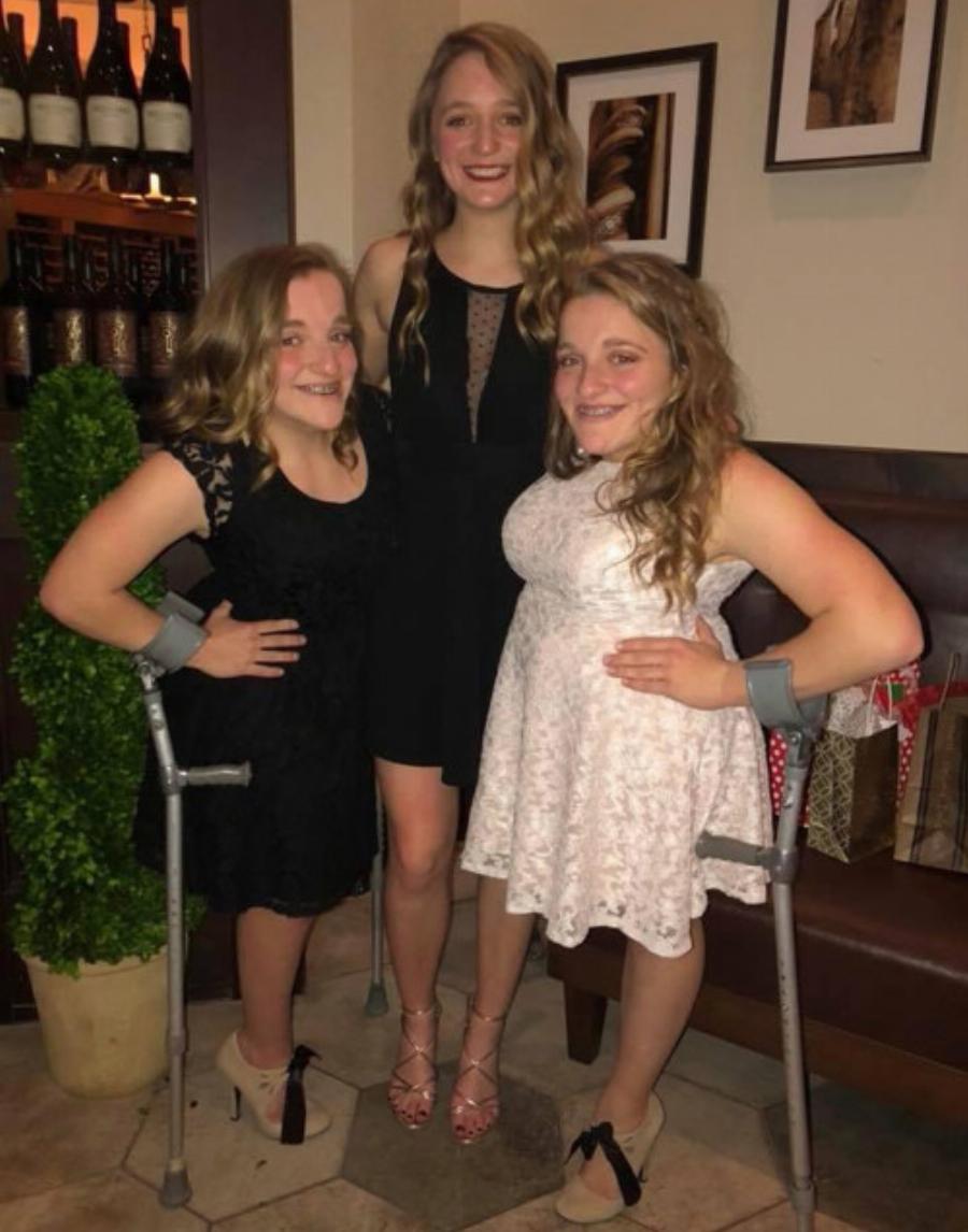 Σπάνιες σιαμαίες δίδυμες: Γεννήθηκαν το 2003, χειρουργήθηκαν για 24 ώρες, σήμερα είναι 2 όμορφες κοπέλες και ζουν ανεξάρτητα