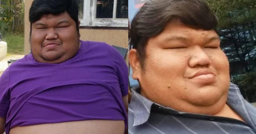 Βίωνε bullying για την εμφάνιση του, παντρεύτηκε την αγάπη της ζωής του και όλοι τον ζηλεύουν σήμερα