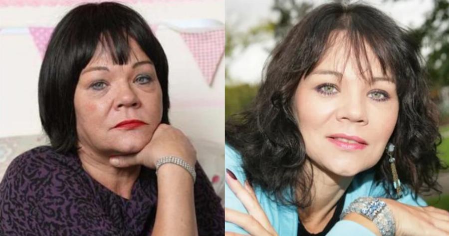 Μάντι Άλτγουντ: Έφυγε από την ζωή στα 56 της η γυναίκα που έκανε όλο τον κόσμο να συγκινηθεί το 1996 όταν έχασε τα οκτάδυμα της