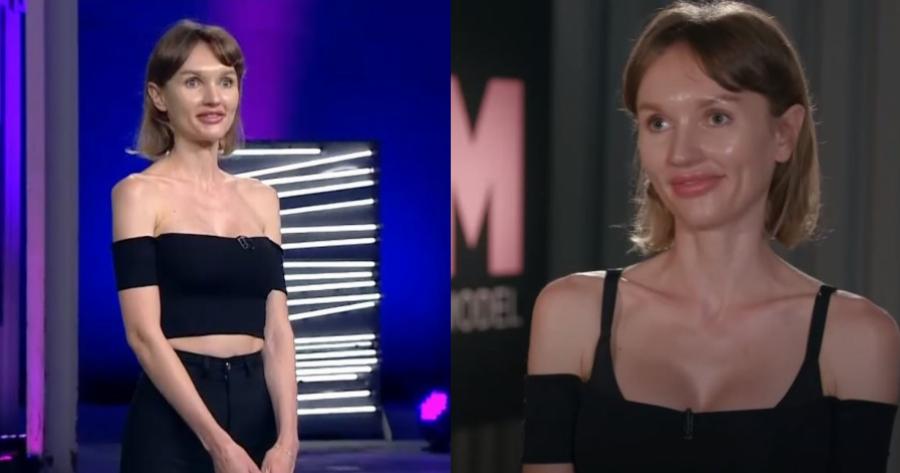 Αλιόνα του GNTM: Η εμμονή με τις πλαστικές επεμβάσεις, στα 33 της μοιάζει με 16χρονο κοριτσάκι