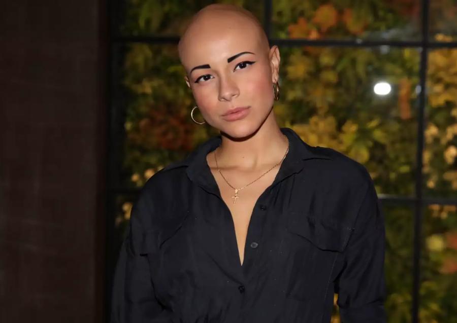 «Μια μέρα ξύπνησα και αποφάσισα να βγάλω την περούκα»: Η συγκινητική εξομολόγηση της Λυδίας Κατσανικάκη για την αλωπεκία