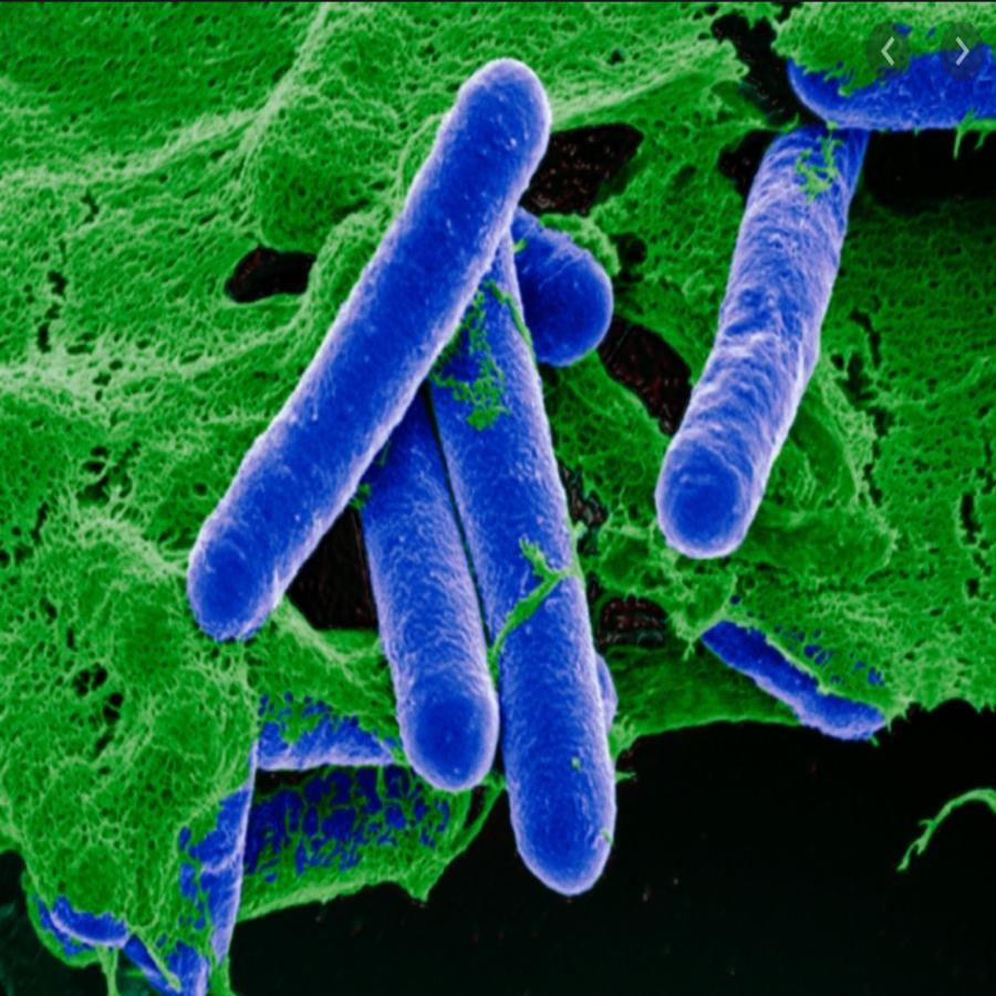 Αλλαντίαση: Τι ακριβώς είναι, ποια είναι τα συμπτώματα της και πως θα προστατευτείτε