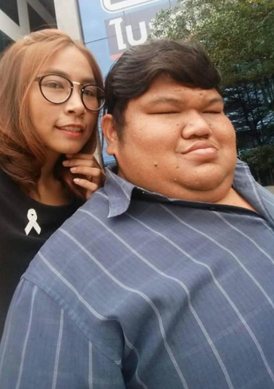 Βίωνε bullying για την εμφάνιση του, παντρεύτηκε την αγάπη της ζωής του και όλοι τον ζηλεύουν σήμερα