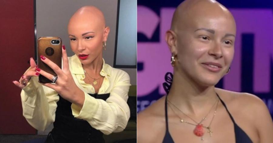 «Μια μέρα ξύπνησα και αποφάσισα να βγάλω την περούκα»: Η συγκινητική εξομολόγηση της Λυδίας Κατσανικάκη για την αλωπεκία