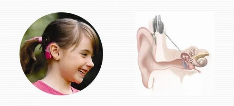 Δίδυμα κοριτσάκια: Γεννήθηκαν κωφά και άκουσαν για πρώτη φορά με τη βοήθεια κοχλιακών εμφυτευμάτων