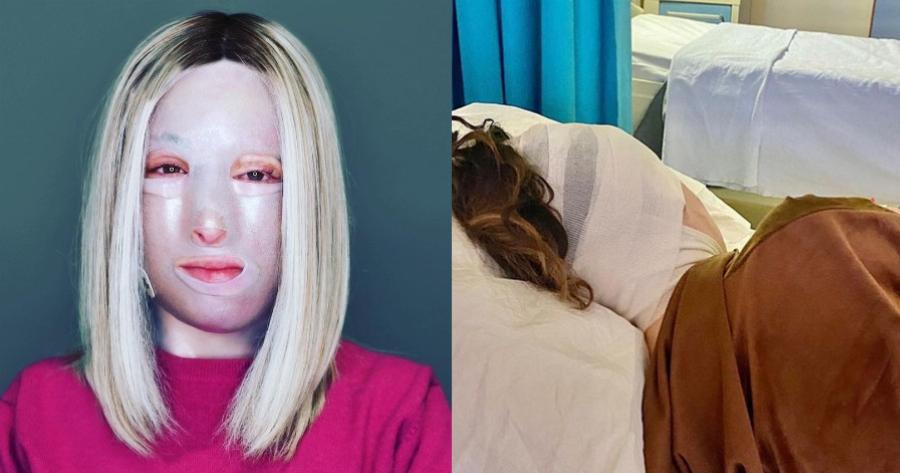 Δύσκολες ώρες για την Ιωάννα Παλιοσπύρου: Η σοβαρή επιπλοκή που παρουσίασε και το 11ο αναγκαστικό χειρουργείο