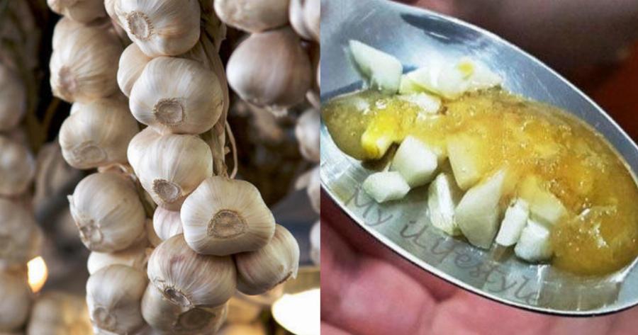 Σκόρδο: Είναι εξαιρετικά αντιοξειδωτικό, βοηθά στην καταπολέμηση φλεγμονών και χρησιμοποιείται κατά λοιμώξεων και μυκήτων