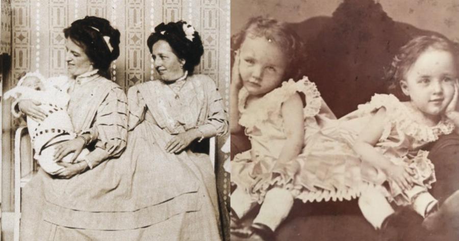 Σιαμαίες δίδυμες: Απίθανη ιστορία των αδερφών Μπλάζεκ που η μία έμεινε έγκυος και χωρίστηκαν μόνο όταν πέθαναν