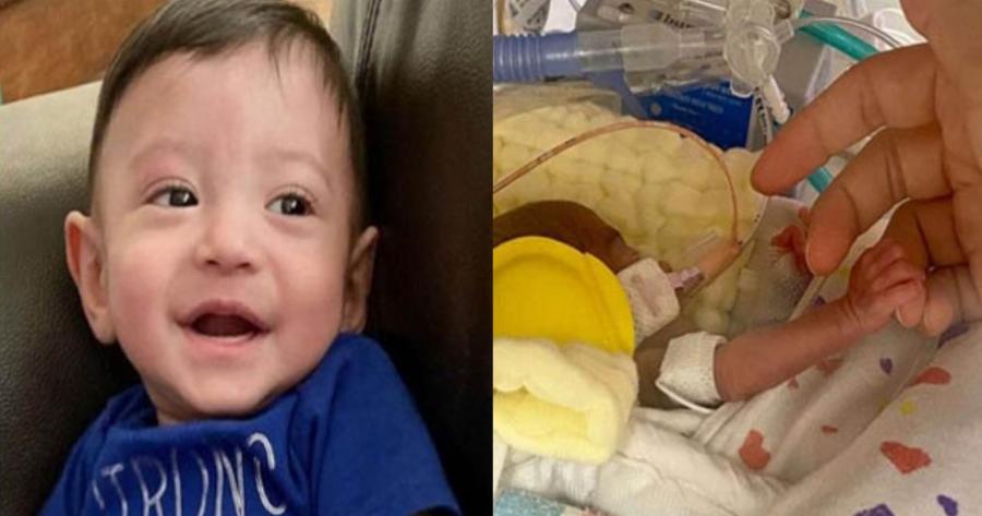 Θαύμα: Πρόωρο μωρό που έζησε από θαύμα γιόρτασε τα πρώτα του γενέθλια