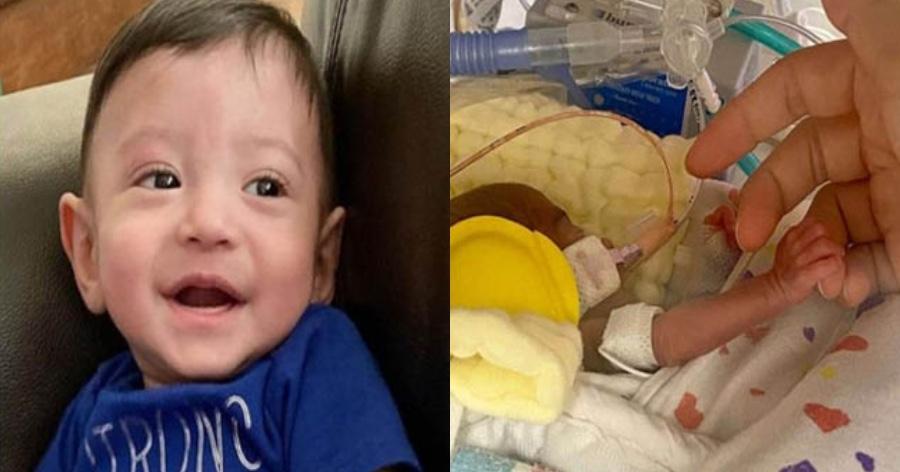 Θαύμα: Πρόωρο μωρό που έζησε από θαύμα γιόρτασε τα πρώτα του γενέθλια