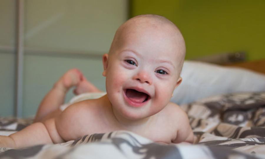 Παγκόσμια Ημέρα για το Σύνδρομο Down: Κάποια χαμόγελα είναι απλά ανεκτίμητα