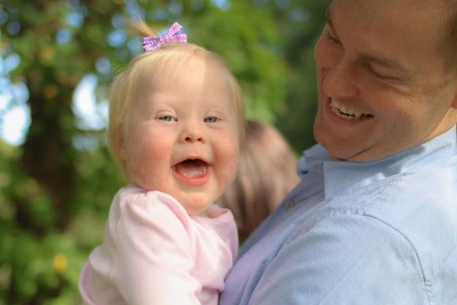 «Αγαπητέ γιατρέ, το παιδί που μου είπατε να «ρίξω» μάς έχει χαρίσει τα πιο πλατιά χαμόγελα»