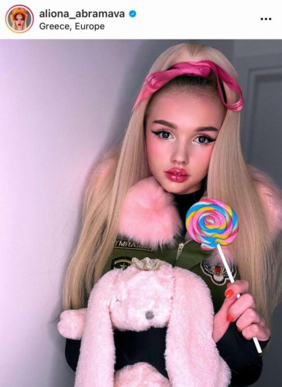 Αλιόνα του GNTM: Η εμμονή με τις πλαστικές επεμβάσεις, στα 33 της μοιάζει με 16χρονο κοριτσάκι