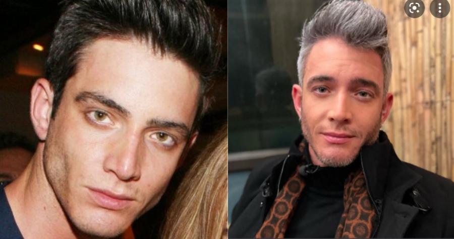 Θεοχάρης Ιωαννίδης: «Στα 16 μου έχασα όλα μου τα μαλλιά»