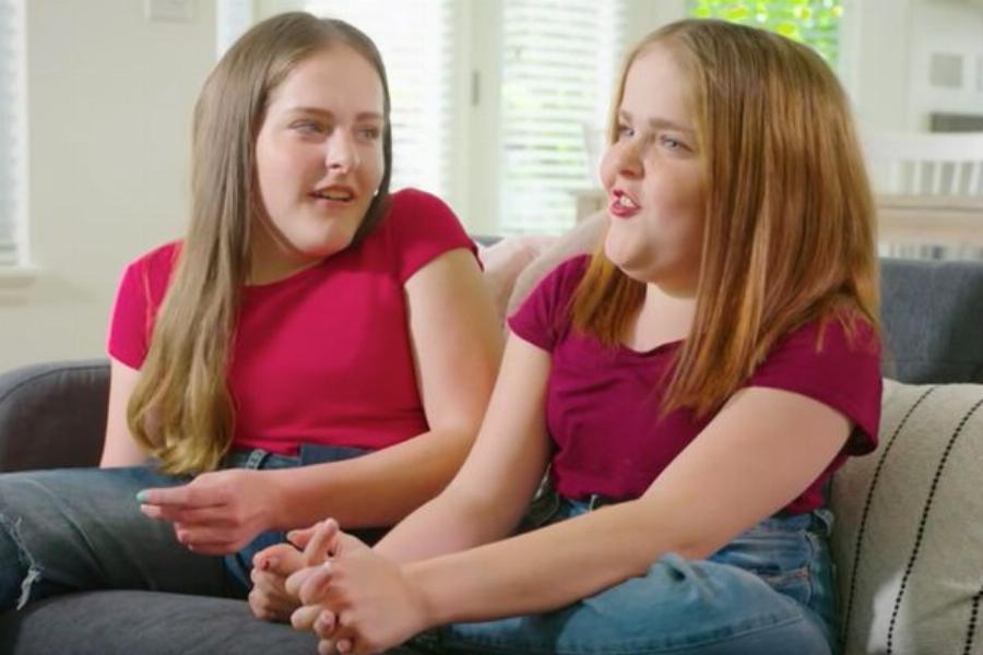 Αληθινή ιστορία: Τα σπάνια σιαμαία δίδυμα που γεννήθηκαν το 2002, σήμερα είναι δυο υπέροχες κοπέλες και έχουν πάρει ξεχωριστούς δρόμους