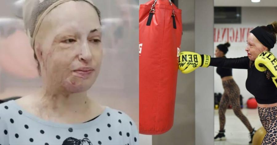 Ιωάννα Παλιοσπύρου: Η νέα της ζωή, η τεράστια δύναμη ψυχής, η τηλεοπτική εμφάνιση και οι νέες φωτογραφίες