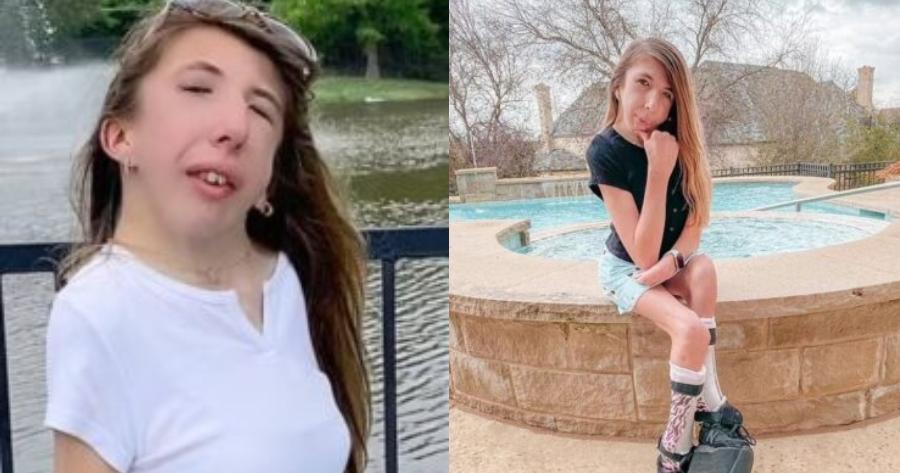 Η 14χρονη με σπάνια πάθηση άντεξε 33 χειρουργεία και η ασφάλιση της δεν καλύπτει καμία θεραπεία