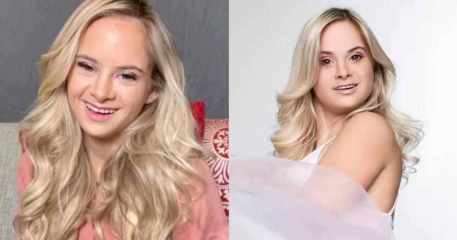 Victoria’s Secret: Η 25χρονη Σοφία έγινε το πρώτο μοντέλο με σύνδρομο Down της γνωστής μάρκας