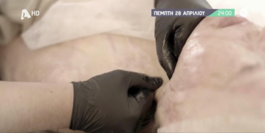 Όμορφη και χωρίς τη μάσκα: Η Ιωάννα Παλιοσπύρου για πρώτη φορά είναι έτοιμη να δείξει το πρόσωπο της μετά την επίθεση