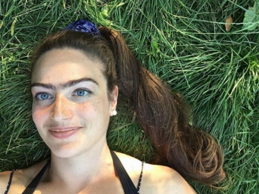 Κοπεγχάγη: Η 31χρονη σταμάτησε να βγάζει φρύδια και μουστάκι –  Νιώθει θηλυκή ακόμη και με τις τρίχες της