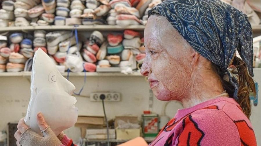 «Τους πρώτους μήνες δεν ήθελα καν να με ακουμπάω»: Η Ιωάννα Παλιοσπύρου χωρίς την μάσκα