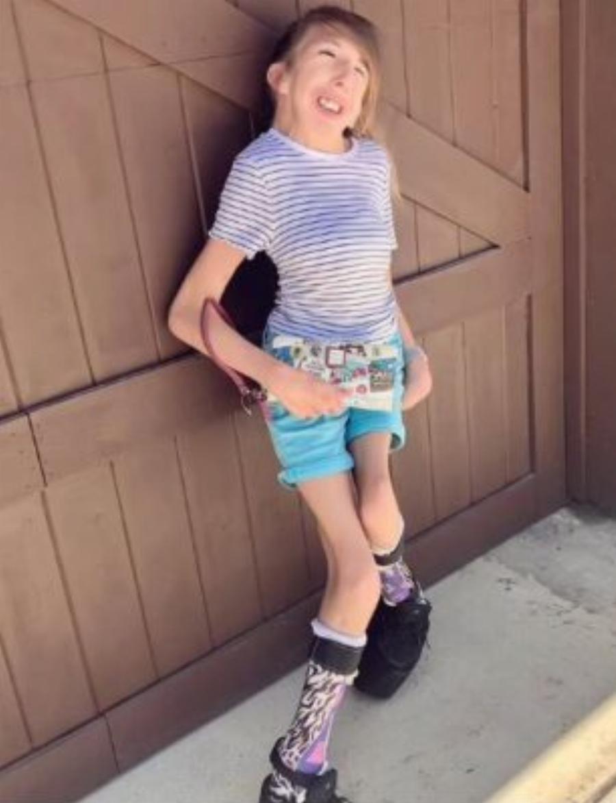 Η 14χρονη με σπάνια πάθηση άντεξε 33 χειρουργεία και η ασφάλιση της δεν καλύπτει καμία θεραπεία