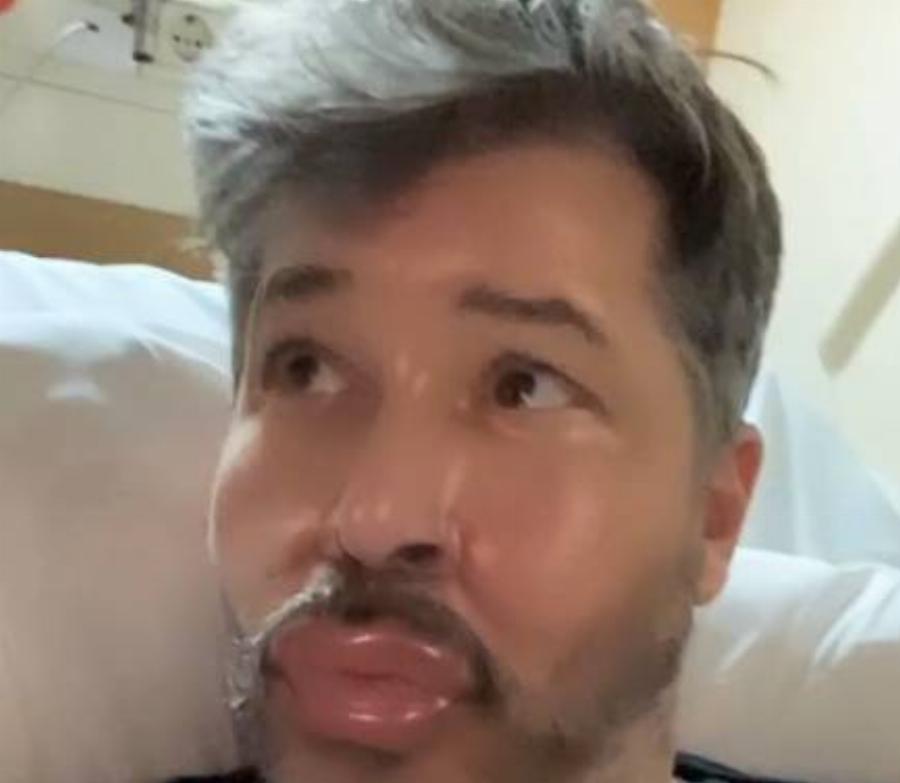 Στο νοσοκομείο ο Χάρης Βαρθακούρης: Το βίντεο στο νοσοκομείο που έγινε viral μετά την επέμβαση και το υαλουρονικό