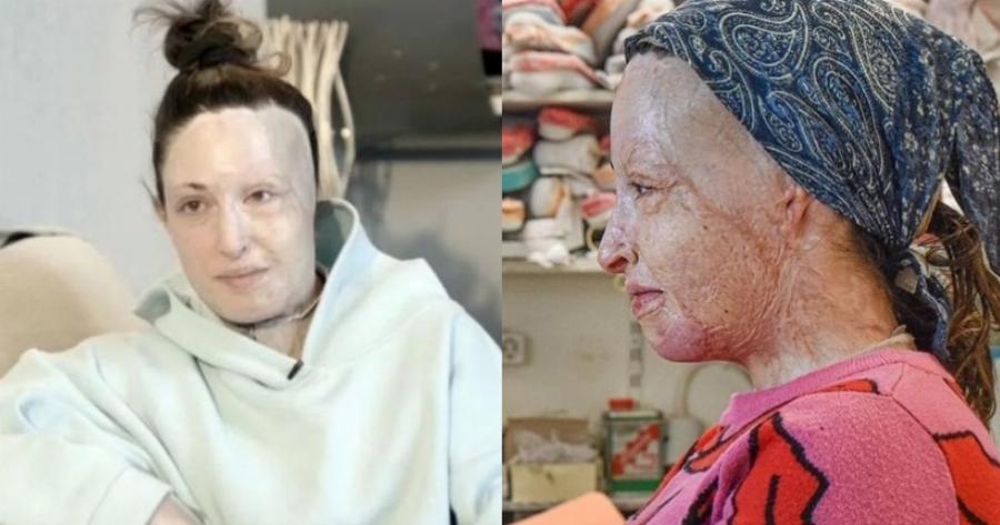 «Τους πρώτους μήνες δεν ήθελα καν να με ακουμπάω»: Η Ιωάννα Παλιοσπύρου χωρίς την μάσκα